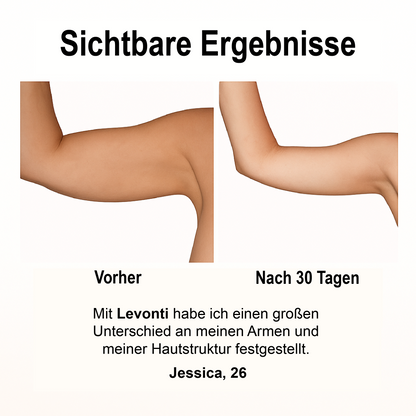 Levonti™ Luxe Armband